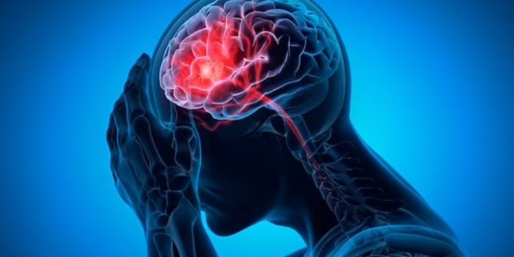 علائم خونریزی مغزی چیست؟