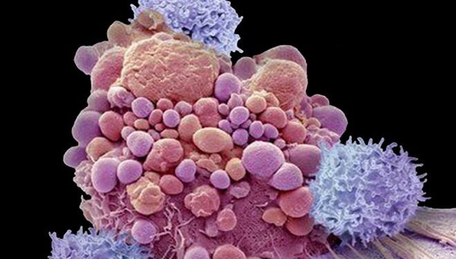 این ماده غذایی خواص ضد سرطان دارد