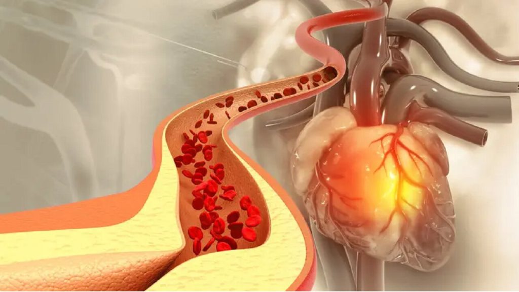 ادویه‌ای که کلسترول خون را کاهش می‌دهد