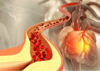 ادویه‌ای که کلسترول خون را کاهش می‌دهد