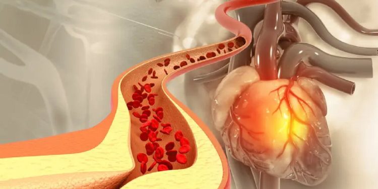 ادویه‌ای که کلسترول خون را کاهش می‌دهد